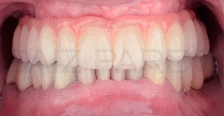 Artículo Revista Gaceta Dental